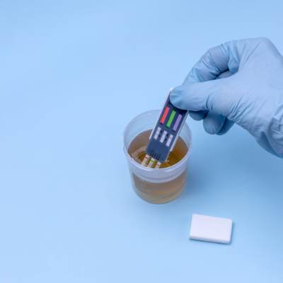 Drug and alcohol testing supplies used for pretrial monitoring